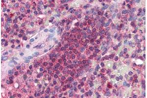 anti-Cerebral Dopamine Neurotrophic Factor (CDNF) (C-Term) antibody