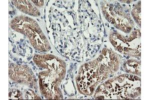 Image no. 1 for anti-butyrobetaine (Gamma), 2-Oxoglutarate Dioxygenase (Gamma-butyrobetaine Hydroxylase) 1 (BBOX1) antibody (ABIN1496815)