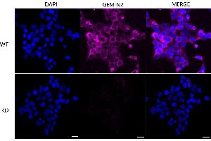 Immunocytochemical staining of Hela cells using GEMIN2 antibody (ABIN7798703), 1:1,000), Top panel: wild-type (WT), Bottom panal: GEMIN2 shRNA knockdown (KD).