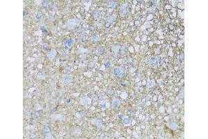 Immunohistochemistry of paraffin-embedded Rat brain using ATP1B2 Polyclonal Antibody at dilution of 1:100 (40x lens).