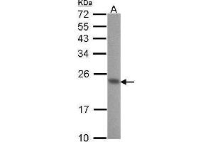 WB Image Sample (30 ug of whole cell lysate) A: A431 , 12% SDS PAGE CIB1 antibody antibody diluted at 1:1000 (CIB1 anticorps)