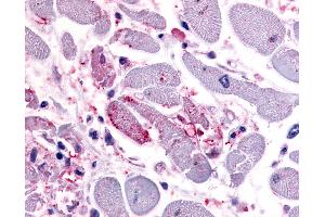Anti-CXCR4 antibody IHC of human heart.