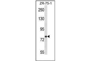 Western blot analysis of SIM1 Antibody (N-term) in ZR-75-1 cell line lysates (35ug/lane). (SIM1 anticorps  (N-Term))