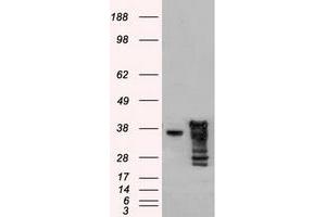 Image no. 1 for anti-DNA Fragmentation Factor, 45kDa, alpha Polypeptide (DFFA) antibody (ABIN1498773) (DFFA anticorps)
