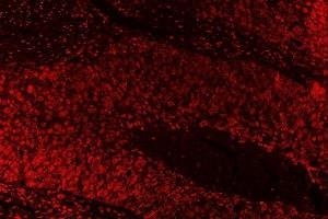 IF analysis of SAE1 using anti-SAE1 antibody (ABIN7601346). (SAE1 anticorps  (AA 33-299))