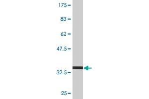 Western Blot detection against Immunogen (35. (TPD52 anticorps  (AA 100-184))