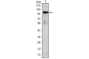 Western Blot showing BMX antibody used against BMX (AA: 138-276)-hIgGFc transfected HEK293 cell lysate. (BMX anticorps)