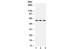 Western blot testing of 1) rat liver, 2) mouse HEPA and 3) human HeLa lysate with ALDH7A1 antibody at 0. (ALDH7A1 anticorps  (AA 333-369))
