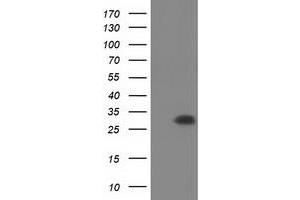 Image no. 1 for anti-Pyrroline-5-Carboxylate Reductase Family, Member 2 (PYCR2) antibody (ABIN1499986)