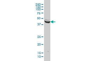 ENO3 monoclonal antibody (M01), clone 5D1 Western Blot analysis of ENO3 expression in HeLa .