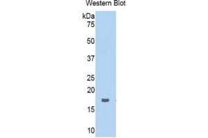 WB of Protein Standard: different control antibodies against Highly purified E. (RPN1 Kit ELISA)