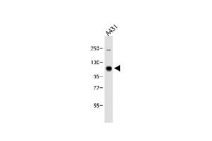 Anti-DDR1 Antibody (Center) at 1:500 dilution + A431 whole cell lysate Lysates/proteins at 20 μg per lane. (DDR1 anticorps  (AA 299-330))