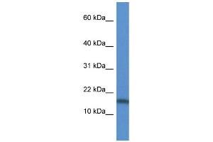 WB Suggested Anti-TNFSF13 AntibodyTitration: 1. (TNFSF13 anticorps  (Middle Region))