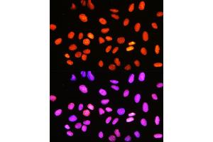 anti-Topoisomerase (DNA) I (TOP1) antibody