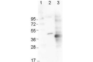 Western Blot using  Immunochemical's Mouse Anti-6x-His Epitope Tag Monoclonal Antibody showing detection of the 6xHis sequence on N-terminally-tagged (lane 2) and C-terminally-tagged recombinant proteins (lane 3). (His Tag anticorps)