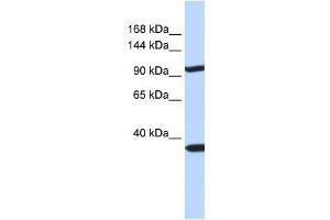 PAPPA2 antibody used at 1 ug/ml to detect target protein.