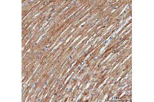 anti-Actin, alpha 1, Skeletal Muscle (ACTA1) (AA 277-308), (C-Term) antibody