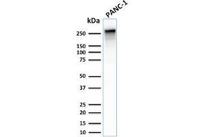 Western Blot Analysis of PANC-1 cell lysate using Spectrin beta III Rabbit Recombinant Monoclonal (SPTBN2/2887R). (Recombinant Spectrin, Beta, Non-erythrocytic 2 (SPTBN2) (AA 356-475) anticorps)