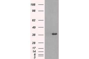 Image no. 1 for anti-Tribbles Pseudokinase 2 (TRIB2) antibody (ABIN1501501) (TRIB2 anticorps)