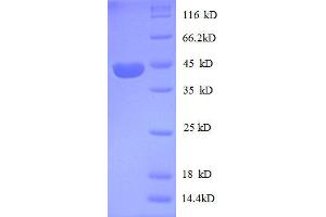 Insulin-Like Growth Factor 2 (IGF2) (AA 30-180), (partial) protein (GST tag)