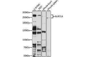 Western blot analysis of extracts of various cell lines, using NUP214 antibody (ABIN6127536, ABIN6144958, ABIN6144959 and ABIN6224385) at 1:1000 dilution. (NUP214 anticorps  (AA 750-1030))