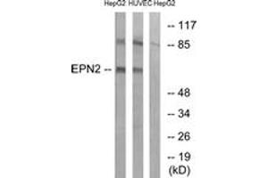 Western blot analysis of extracts from HepG2/HuvEc cells, using EPN2 Antibody. (Epsin 2 anticorps  (AA 271-320))