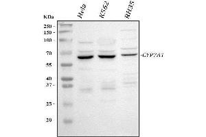 Western blot analysis of CYP7A1 using anti-CYP7A1 antibody (ABIN3042786).