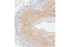 Immunohistochemical analysis of paraffin-embedded human esophagus tissue using C performed on the Leica® BOND RXm.