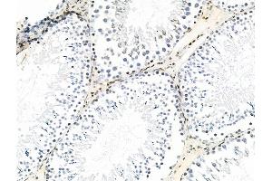 ABIN7093286 and ABIN7097305 at 1/100 staining Rat testis tissue by IHC-P. (CBX5 anticorps  (pSer92))