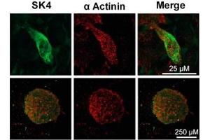 Expression of KCNN4 channel in human cytotrophoblastsImmunocytochemical staining of human cytotrophoblast using Mouse Anti-KCNN4 (KCa3.