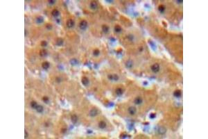 IHC-P analysis of Liver tissue, with DAB staining. (Glucocorticoid Receptor anticorps  (AA 564-733))