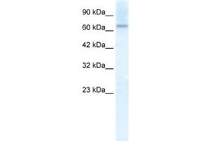 WB Suggested Anti-PIAS2 Antibody Titration:  2. (PIAS2 anticorps  (C-Term))