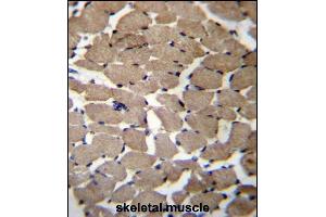 MGAT4C Antibody (C-term) (ABIN656550 and ABIN2845812) immunohistochemistry analysis in formalin fixed and paraffin embedded human skeletal muscle followed by peroxidase conjugation of the secondary antibody and DAB staining.