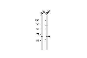 All lanes : Anti-MLLT1 Antibody  at 1:2000 dilution Lane 1: Raji whole cell lysates Lane 2: Hela whole cell lysates Lysates/proteins at 20 μg per lane. (MLLT1 anticorps  (C-Term))