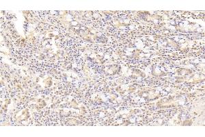 Detection of PRAME in Human Small intestine Tissue using Polyclonal Antibody to Preferentially Expressed Antigen In Melanoma (PRAME) (PRAME anticorps  (AA 416-502))
