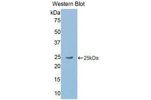 Western Blotting (WB) image for anti-Gastrokine 2 (GKN2) (AA 21-184) antibody (ABIN2117758)