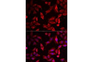 Immunofluorescence analysis of HeLa cells using SERPINB9 antibody. (SERPINB9 anticorps  (AA 1-376))