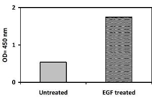 Image no. 1 for PTK2B Protein tyrosine Kinase 2 beta (PTK2B) ELISA Kit (ABIN1981726)