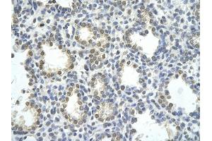Rabbit Anti-ZNF264 antibody         Paraffin Embedded Tissue:  Human Lung    cell Cellular Data:  alveolar cell    Antibody Concentration:  4. (ZNF264 anticorps  (N-Term))