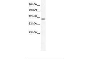Image no. 1 for anti-Zinc Finger Protein 365 (ZNF365) (AA 33-82) antibody (ABIN202270) (ZNF365 anticorps  (AA 33-82))
