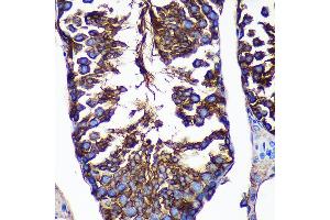 Immunohistochemistry of paraffin-embedded Mouse testis using CTNN Rabbit pAb (ABIN7266136) at dilution of 1:100 (40x lens).