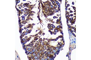 Immunohistochemistry of paraffin-embedded Mouse testis using CTNN Rabbit pAb (ABIN7266136) at dilution of 1:100 (40x lens). (CTNNA3 anticorps  (AA 1-240))
