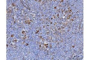 IHC analysis of Axin 2/AXIN2 using anti-Axin 2/AXIN2 antibody (ABIN7602177). (AXIN2 anticorps  (AA 614-843))
