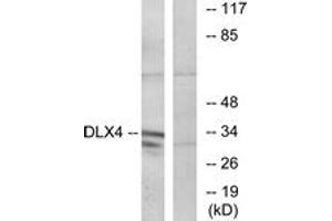 Western blot analysis of extracts from COLO cells, using DLX4 Antibody. (DLX4 anticorps  (AA 61-110))