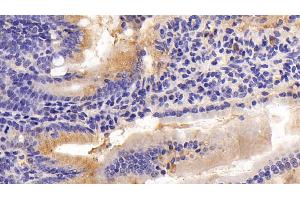 Detection of MPIF2 in Mouse Small intestine Tissue using Polyclonal Antibody to Myeloid Progenitor Inhibitory Factor 2 (MPIF2) (CCL24 anticorps  (AA 27-119))