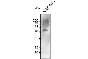 Western Blotting (WB) image for anti-Protein Phosphatase 1, Regulatory Subunit 8 (PPP1R8) antibody (ABIN7272976) (PPP1R8 anticorps)