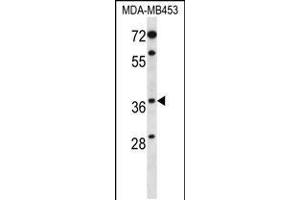 Western blot analysis in MDA-MB453 cell line lysates (35ug/lane).