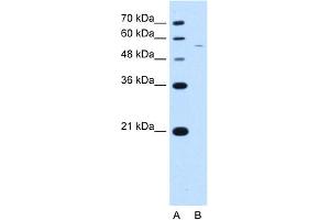 WB Suggested Antibody Titration:  2. (RSRC2 anticorps  (C-Term))