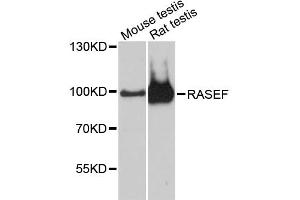Western blot analysis of extracts of various cell lines, using RASEF antibody (ABIN6293519) at 1:3000 dilution.