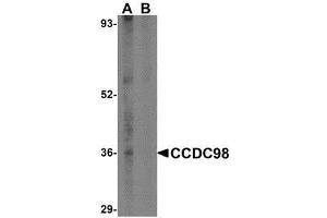 Western blot analysis of CCDC98 in human breast tissue lysate in (A) the absence and (B) presence of blocking peptide with AP30214PU-N CCDC98 antibody at 1 μg/ml. (CCDC98 anticorps  (N-Term))